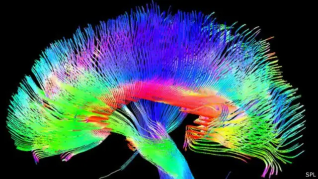 نموذج للخلايا العصبية بالمخ البشري