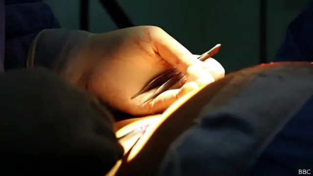 Intervención quirúrgica