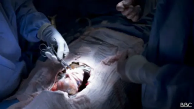 'එක් වකුගඩුවක් සඳහා ඩොලර් දෙදහස් පන්සියයක්'