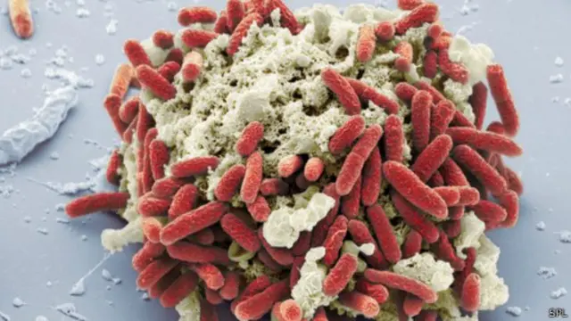 E.coli