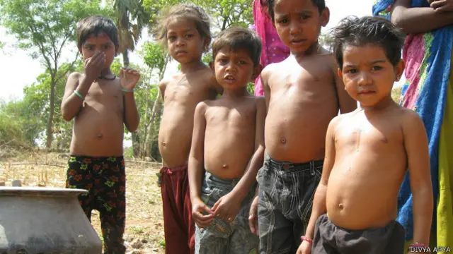 गुजरात कुपोषित बच्चे