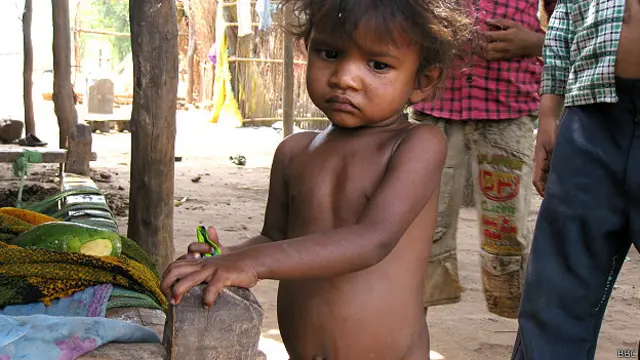 गुजरात बाल कुपोषण