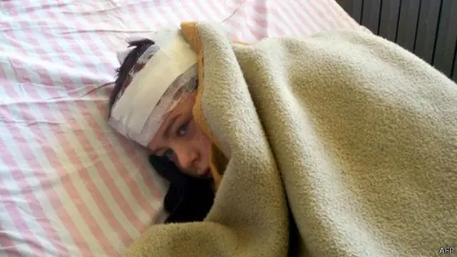 叙利亚受伤儿童