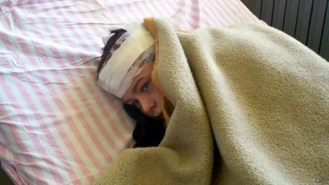 Сирия: раненый ребенок в Хаме