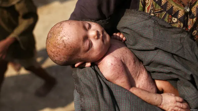 রাখাইনের শরণার্থী শিবির