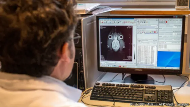 گردش خون و کارکرد مغز موشهای پیر با تزریق خون موش جوان بهتر شد