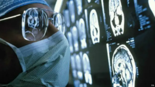 مسح المخ بالأشعة 