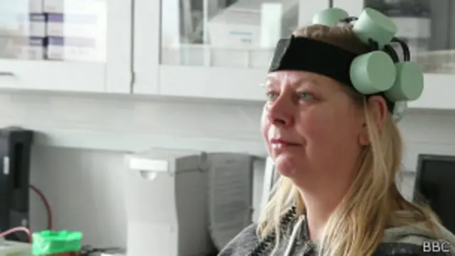 La mayoría de los pacientes del ensayo dijeron que los síntomas de la depresión desaparecieron tras el uso del casco.