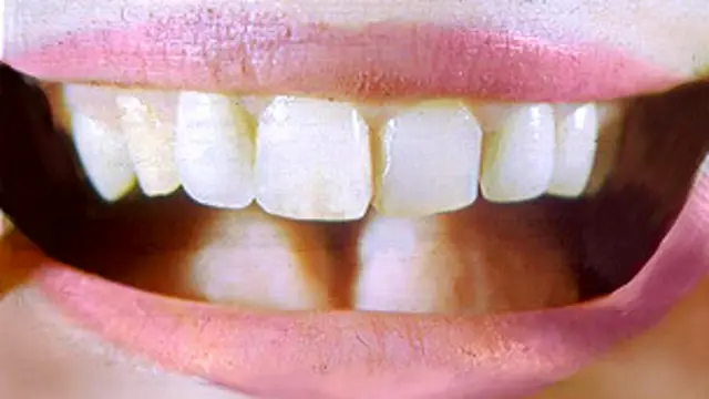 A plate of food, not of problems