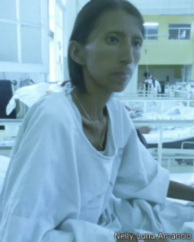 Además de sida, Nela Kuja Chumpi tiene tuberculosis, Hepatitis C y desnutrición crónica.