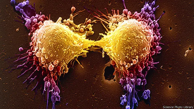 प्रॉस्टैट कैंसर की कोशिकाएं