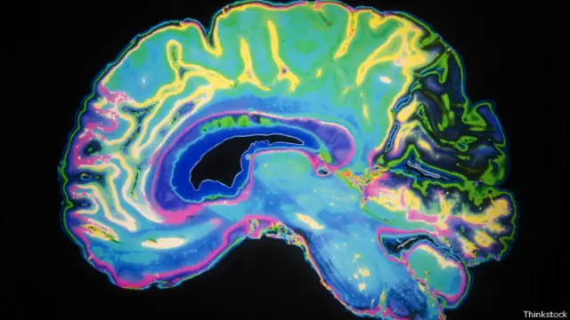 Scáner coloreado del cerebro