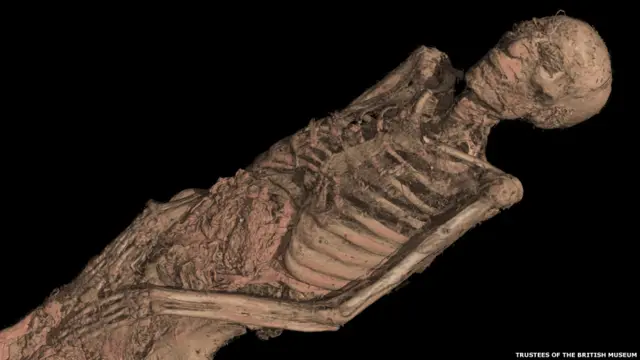 Компьютерная томография останков мумии