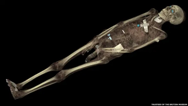 Компьютерная томография останков мумии