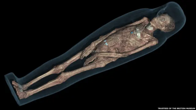 Компьютерная томография останков мумии