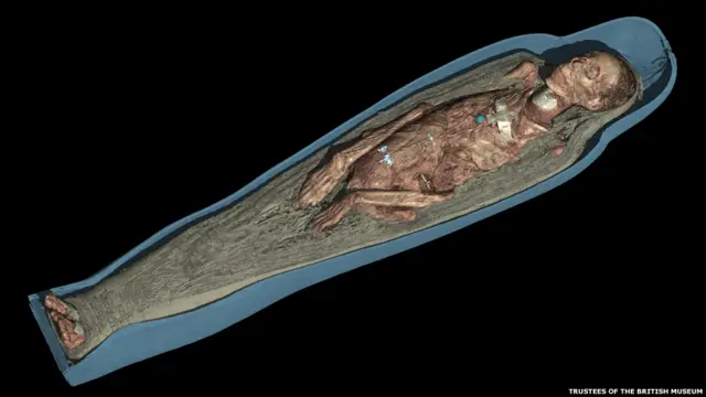 Компьютерная томография останков мумии