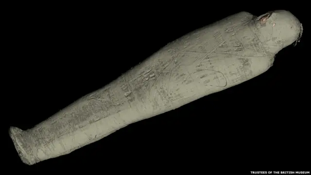 Компьютерная томография останков мумии