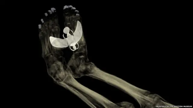 Компьютерная томография ног мумии Тамут