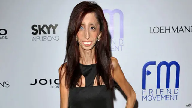 Lizzie Velásquez