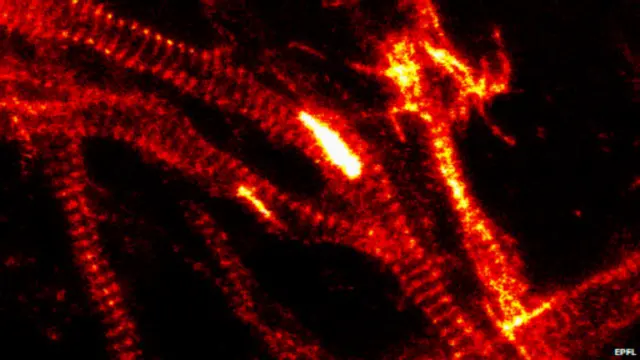 Скелет клітини