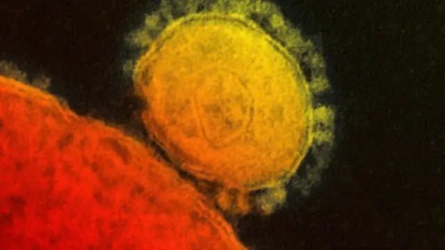 مرض كورونا قتل حتى الآن ثلث من أصيبوا بالعدوى.