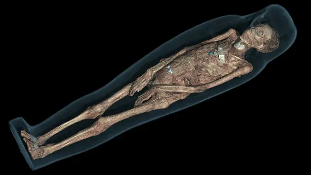 Сканирование мумии