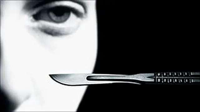 Cirugías estéticas (foto: BBC)