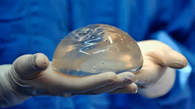 implante de silicona