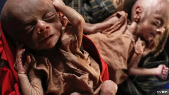 Gemelos Ruksuma y Kulsuma