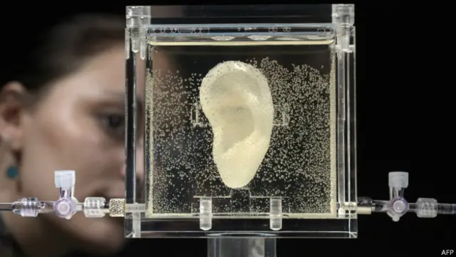 "Ухо" ван Гога