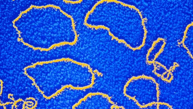 تتحكم الجينات المخلقة طبيعيا في مقاومة المضادات الحيوية التي تتواجد في البكتيريا