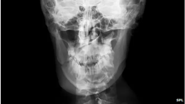 Penelitian sebelumnya mengungkapkan evolusi wajah pria disebabkan oleh jenis makanan.