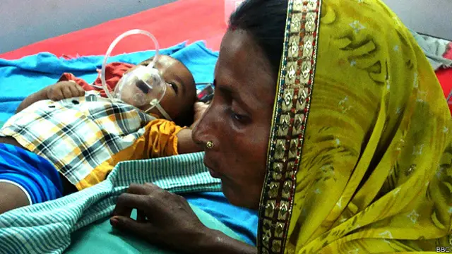 मुजफ्फरपुर के एसकेएमसीएच में भर्ती एक बच्चा