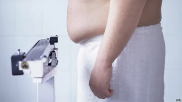 Ожирение как инвалидность