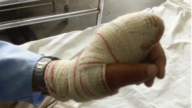 یکی از آنها گفت: اگر ده انگشت دست من هم قطع شود، رای می‌دهم. این کار از دستم برمی‌آید