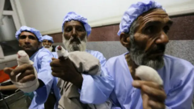 Wasu 'yan Afghanistan da aka yanke wa yatsu