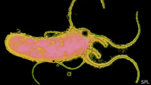 Кампилобактерия