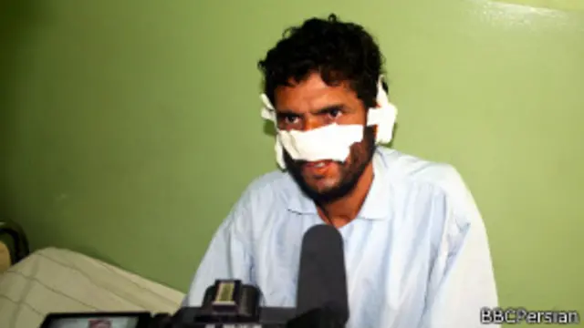 طالبان در انتخابات پنج سال پیش گوشها و بینی یک رایدهنده و انگشتان دو رایدهنده دیگر را بریده بودند