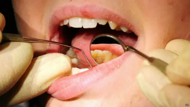 Nova tecnologia poderá significar o fim das assustadoras brocas