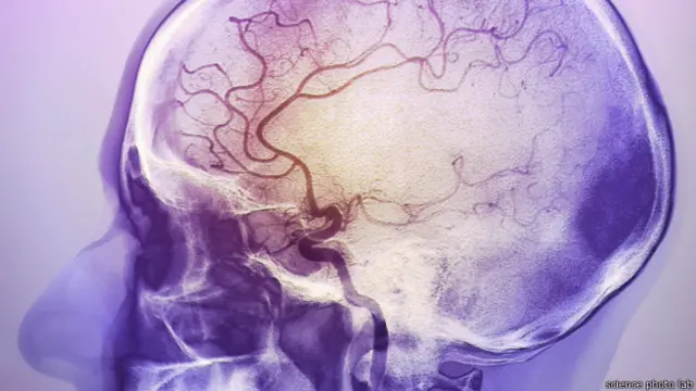 मानव मस्तिष्क