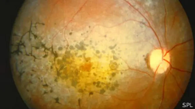 interior de una retina