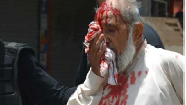 پولیس اور منہاج القرآن کے کارکنوں کے درمیان یہ تصادم اس وقت شروع ہوا جب پولیس نے منہاج القرآن سیکریٹیریٹ اور طاہر القادری کے گھر کے ارد گرد لگی حفاظتی رکاوٹیں ہٹانے کی کوشش کی