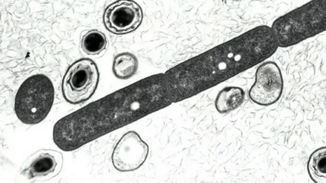 एंथ्रेक्स