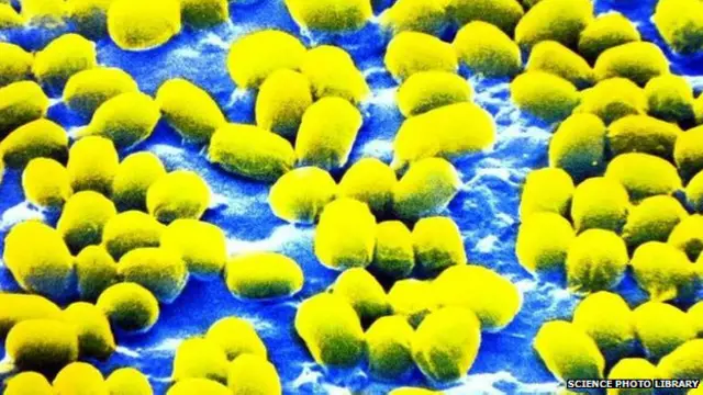 एंथ्रेक्स