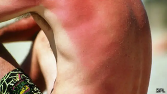 Hombre tomando el sol