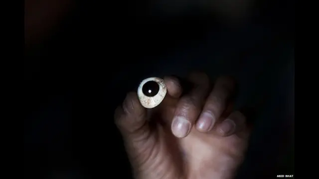 अध्ययन में कहा गया है कि पेलेट गन से लगी चोट के कारण पांच लोगों की आंखों की रोशनी चली गई. इनमें सबसे छोटे व्यक्ति की उम्र छह साल और सबसे बुजुर्ग व्यक्ति की उम्र 54 वर्ष थी.