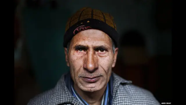 मुश्ताक़ अहमद नजर श्रीनगर में रहते हैं. उनका कहना है कि वो स्थानीय बाज़ार में सब्ज़ी खरीदने गए थे, जहां एक छोटा सा प्रदर्शन चल रहा था. इसी दौरान सुरक्षा बलों ने पेलेट गनें चलाईं और इससे उनकी दाईं आंख में चोट आई जिससे एक आंख देखने के काबिल नहीं रह पाई. 