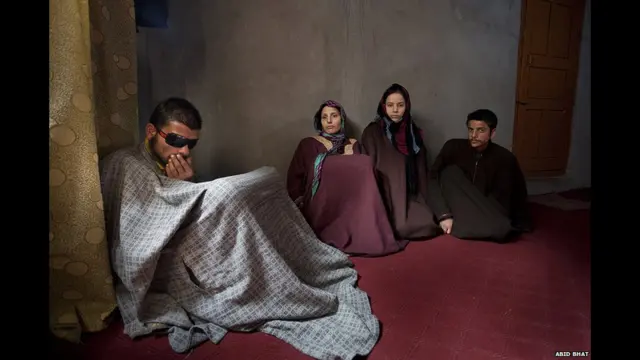 फेरी लगाने वाले 19 वर्षीय तारिक अहमद गोजरी की दाहिनी आंख की रोशनी पेलेट गन से लगी चोट के कारण चली गई है. गोजरी का कहना है कि ये चोट उन्हें पिछले साल लगी जब वो एक प्रदर्शन में फंस गए जबकि वो तो पड़ोस से दूध लाने के लिए गए थे.