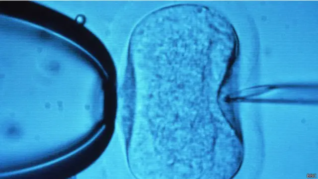 Fertilización in vitro