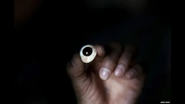 भारत प्रशासित कश्मीर, बंदूक के छर्रे, प्रभावित होती ज़िंदगी